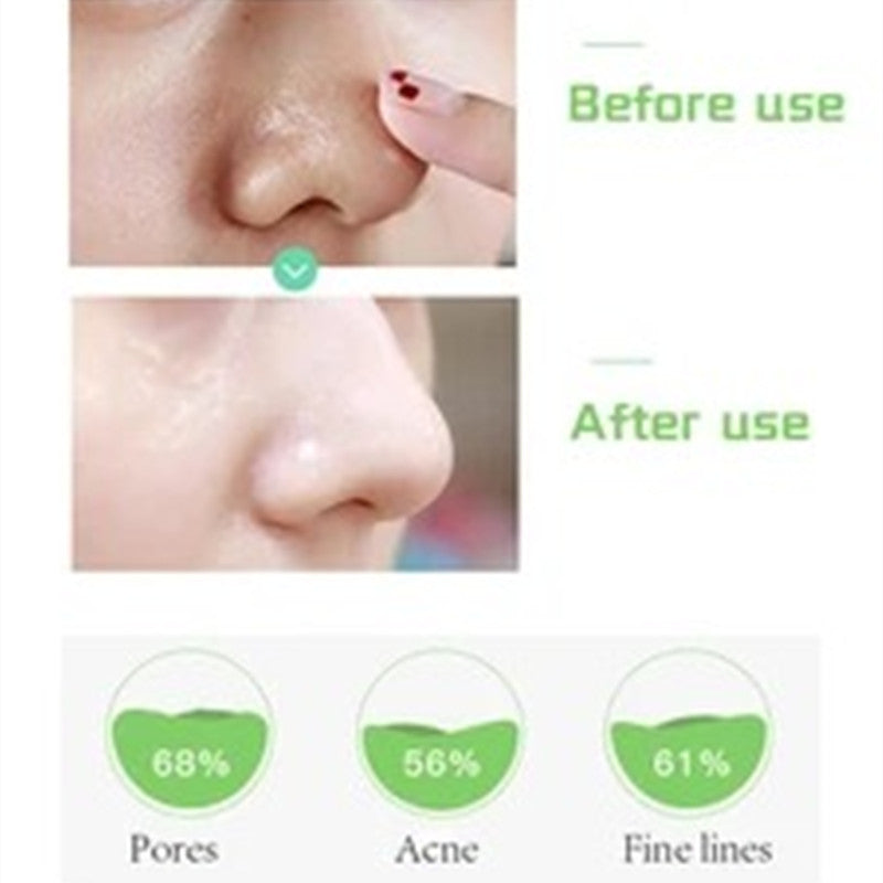 Pore-Refining | Hydrating | Lightweight Serum